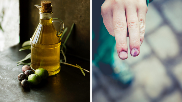 7 Best Essential Oil For Bruises - To Soothe Inflammation And Pain Relief!